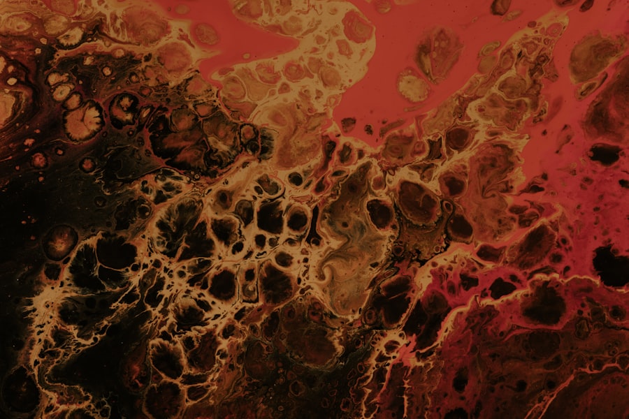 Chronic Inflammatory Response Syndrome
